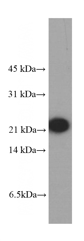 human testis tissue were subjected to SDS PAGE followed by western blot with Catalog No:107464(PRDX2 Antibody) at dilution of 1:2000