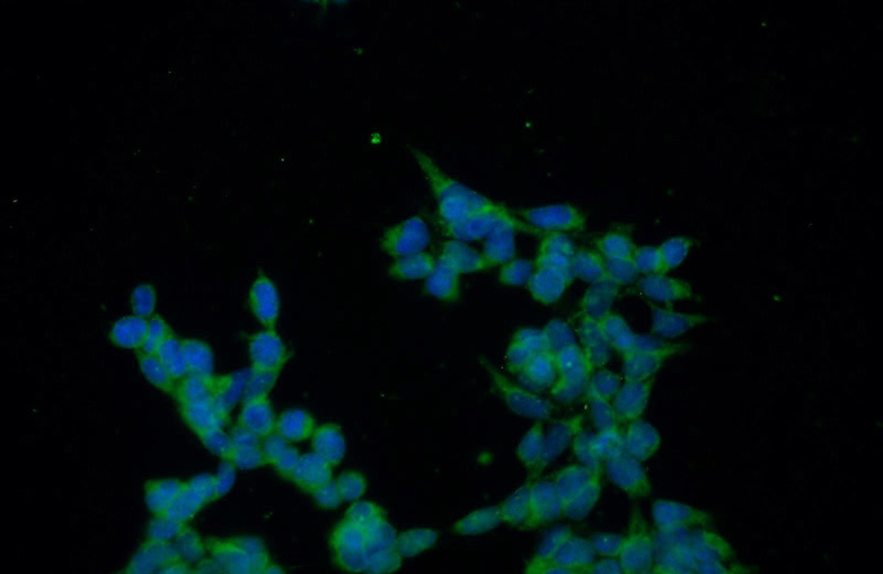 Immunofluorescent analysis of HEK-293 cells using Catalog No:108738(C5orf44 Antibody) at dilution of 1:50 and Alexa Fluor 488-congugated AffiniPure Goat Anti-Rabbit IgG(H+L)