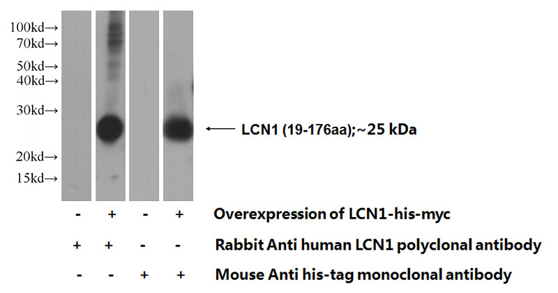 Transfected HEK-293 cells were subjected to SDS PAGE followed by western blot with Catalog No:112173(LCN1 Antibody) at dilution of 1:1000