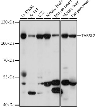 Western blot - TARSL2 Polyclonal Antibody 
