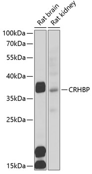 Western blot - CRHBP Polyclonal Antibody 