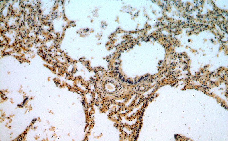 Immunohistochemical of paraffin-embedded human lung using Catalog No:116372(TSSC4 antibody) at dilution of 1:50 (under 10x lens)