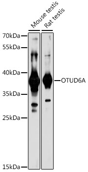Western blot - OTUD6A Polyclonal Antibody 