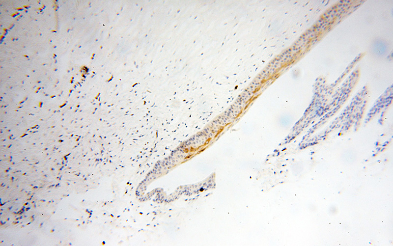 Immunohistochemical of paraffin-embedded human eye using Catalog No:116491(TULP1 antibody) at dilution of 1:50 (under 10x lens)