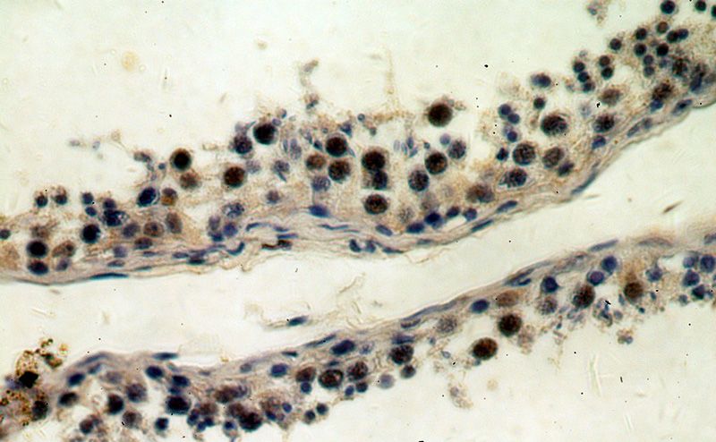 Immunohistochemical of paraffin-embedded human testis using Catalog No:114622(REXO4,REX4 antibody) at dilution of 1:100 (under 40x lens)