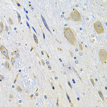 Immunohistochemistry - LGR6 Polyclonal Antibody 