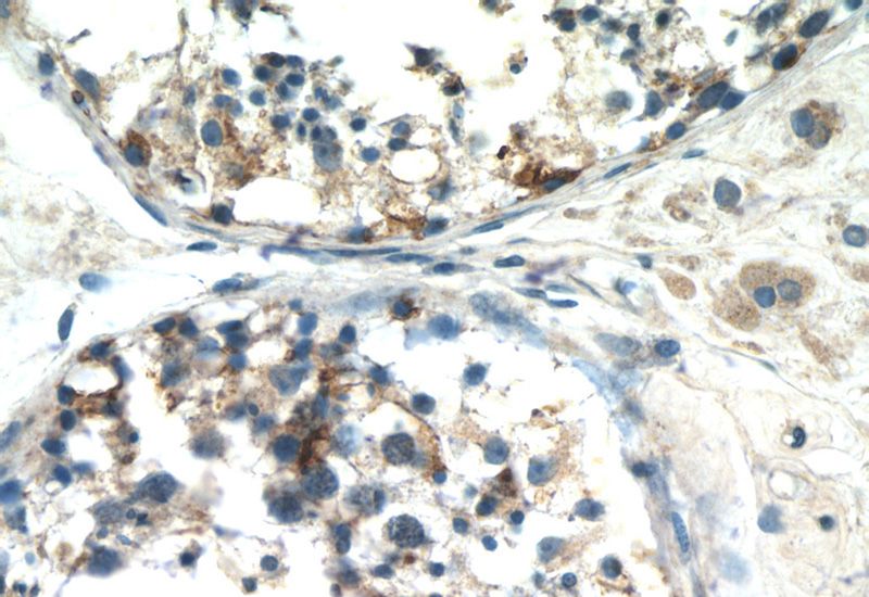 Immunohistochemistry of paraffin-embedded human testis tissue slide using Catalog No:110036(DTX1 Antibody) at dilution of 1:50 (under 40x lens)
