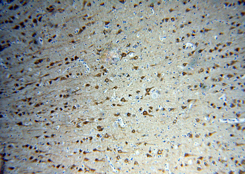 Immunohistochemical of paraffin-embedded human brain using Catalog No:113128(NRGN antibody) at dilution of 1:50 (under 10x lens)