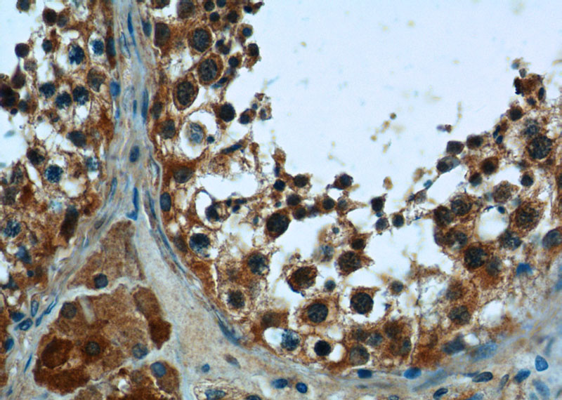 Immunohistochemistry of paraffin-embedded human testis tissue slide using Catalog No:113975(PNLDC1 Antibody) at dilution of 1:50 (under 40x lens)