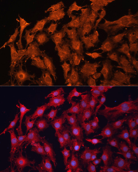 Immunofluorescence - P Glycoprotein Polyclonal Antibody 