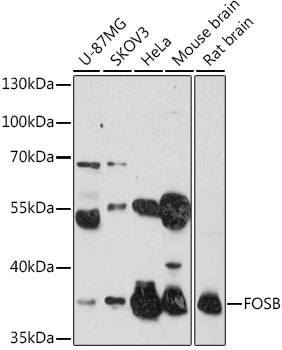 Western blot - FOSB Polyclonal Antibody 
