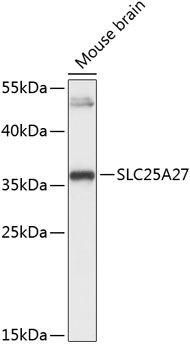Western blot - SLC25A27 Polyclonal Antibody 
