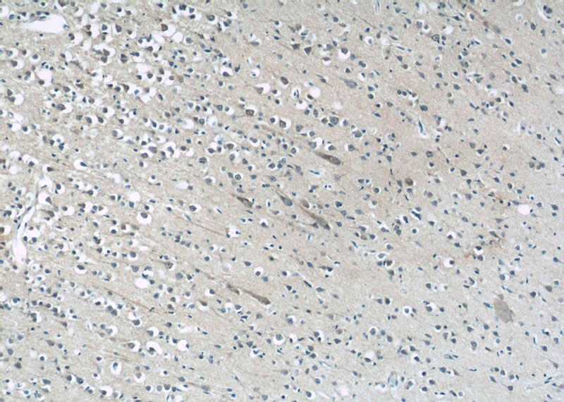 Immunohistochemistry of paraffin-embedded human brain tissue slide using Catalog No:112534(MFSD8 Antibody) at dilution of 1:50 (under 10x lens)