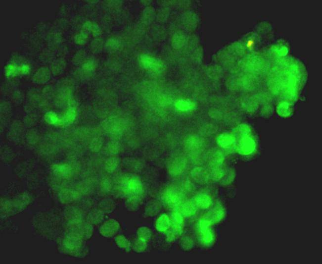 Fig2: Immunofluorescence staining CRISPR-Cas9 in CRISPR-Cas9 transfected 293T cells (green). Cells were fixed in paraformaldehyde, permeabilised with 0.25% Triton X100/PBS.