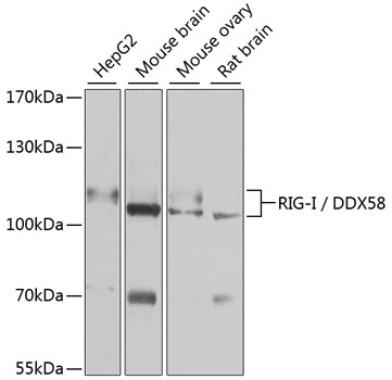 Western blot - RIG-I / DDX58 Polyclonal Antibody 