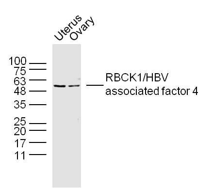 Fig1: Sample:; Uterus(mouse) Lysate at 40 ug; ovary(mouse) Lysate at 40 ug; Primary: Anti-RBCK1/HBV associated factor 4 (175657#4R) at 1/300 dilution; Secondary: IRDye800CW Goat Anti-Rabbit IgG at 1/20000 dilution; Predicted band size: 56 kD; Observed band size: 56 kD