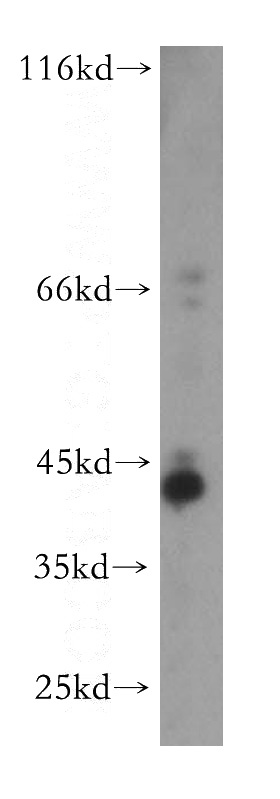 human liver tissue were subjected to SDS PAGE followed by western blot with Catalog No:116205(TMLHE antibody) at dilution of 1:500