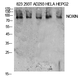 Fig1:; Western Blot analysis of 823, 293T, AD293, Hela, HepG2 cells using NOXIN Polyclonal Antibody. Antibody was diluted at 1:2000. Secondary antibody（catalog#: HA1001) was diluted at 1:20000
