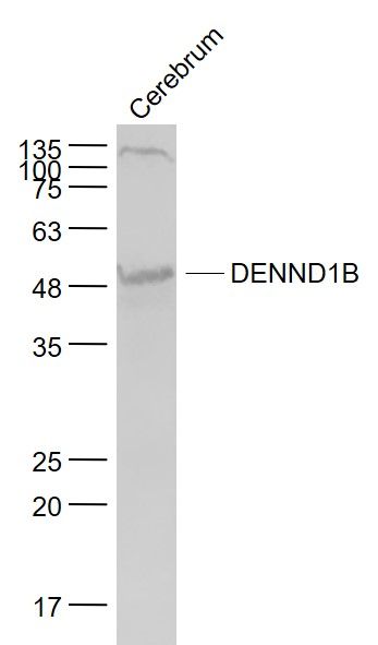Fig1: Sample:; Cerebrum (Mouse) Lysate at 40 ug; Primary: Anti- DENND1B at 1/1000 dilution; Secondary: IRDye800CW Goat Anti-Rabbit IgG at 1/20000 dilution; Predicted band size: 48 kD; Observed band size: 49 kD