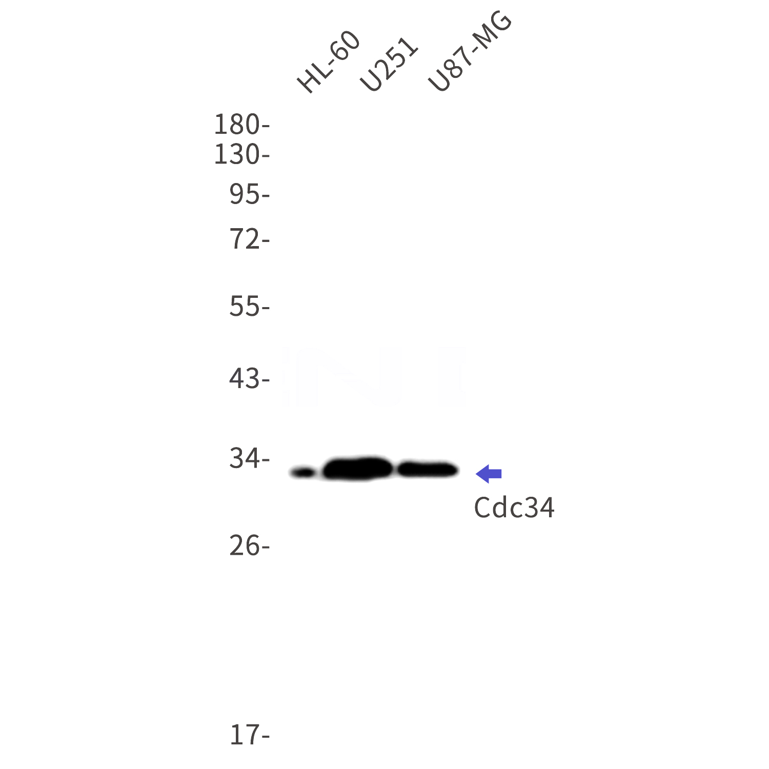 Western blot detection of Cdc34 in HL-60,U251,U87-MG cell lysates using Cdc34 Rabbit mAb(1:1000 diluted).Predicted band size:27kDa.Observed band size:32kDa.