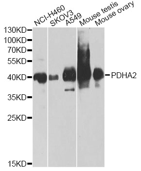 Western blot - PDHA2 Polyclonal Antibody 
