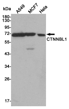 Western blot detection of CTNNBL1 in A549,MCF7 and Hela cell lysates using CTNNBL1 mouse mAb (1:500 diluted).Predicted band size:65KDa.Observed band size:65KDa.