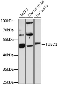 Western blot - TUBD1 Polyclonal Antibody 