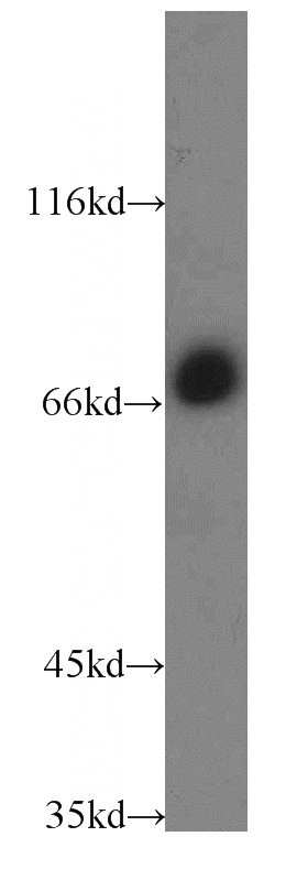 HeLa cells were subjected to SDS PAGE followed by western blot with Catalog No:109186(CEP72 antibody) at dilution of 1:1000