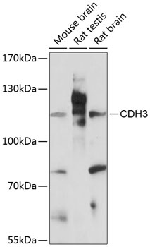 Western blot - CDH3 Polyclonal Antibody 