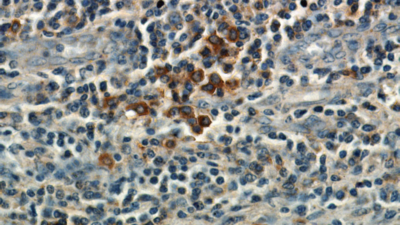 Immunohistochemical of paraffin-embedded human tonsil using Catalog No:113931(PLAC8 antibody) at dilution of 1:50 (under 40x lens)