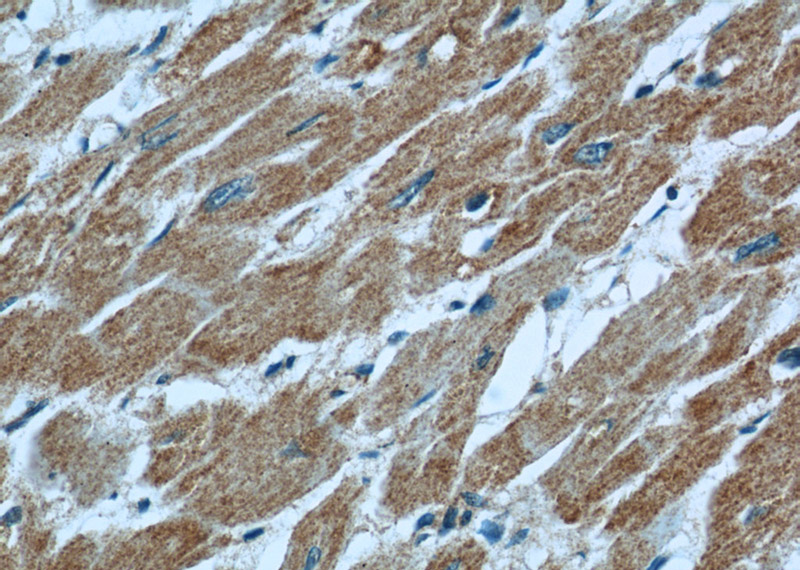 Immunohistochemical of paraffin-embedded human heart using Catalog No:112289(LNPEP antibody) at dilution of 1:50 (under 40x lens)