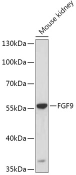 Western blot - FGF9 Polyclonal Antibody 