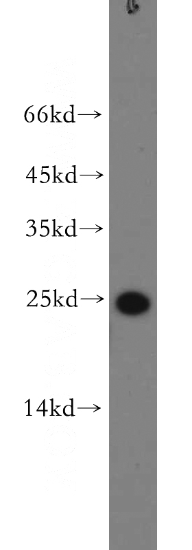 A549 cells were subjected to SDS PAGE followed by western blot with Catalog No:115158(SFTPC antibody) at dilution of 1:300