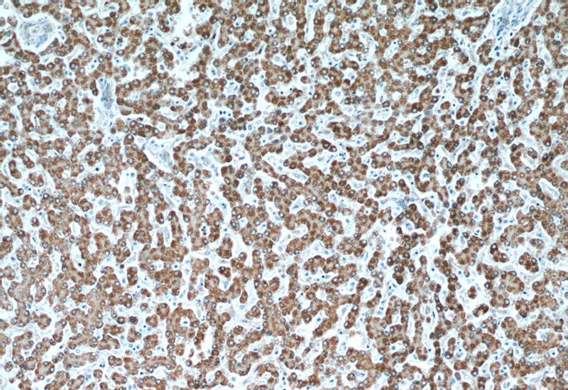 Immunohistochemical of paraffin-embedded human liver using Catalog No:113493(PAICS antibody) at dilution of 1:50 (under 10x lens)
