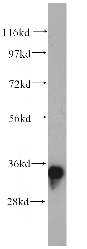 human brain tissue were subjected to SDS PAGE followed by western blot with Catalog No:108009(PRKAB2 antibody) at dilution of 1:400