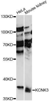 Western blot - KCNK3 Polyclonal Antibody 
