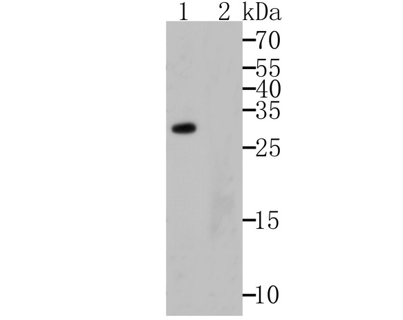 Fig1: Western blot analysis of APR3 on human skin tissue lysates using anti-APR3 antibody.; Lane 1: Anti-APR3 antibody (1/500).; Lane 2: Anti-APR3 antibody, pre-incubated with the immunizaiton peptide.