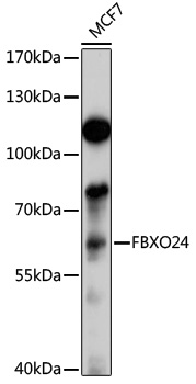 Western blot - FBXO24 Polyclonal Antibody 