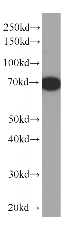 Bovine serum tissue were subjected to SDS PAGE followed by western blot with Catalog No:107024(BSA Antibody) at dilution of 1:4000