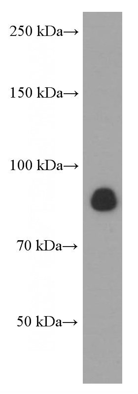 PC-3 cells were subjected to SDS PAGE followed by western blot with (CX3CL1 Antibody) at dilution of 1:1000