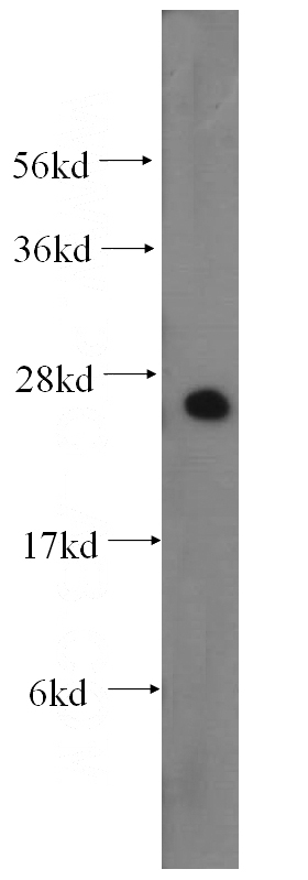 human testis tissue were subjected to SDS PAGE followed by western blot with Catalog No:109767(DCXR antibody) at dilution of 1:500