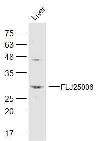 Fig1: Sample:; Liver (Mouse) Lysate at 40 ug; Primary: Anti-FLJ25006 at 1/300 dilution; Secondary: IRDye800CW Goat Anti-Rabbit IgG at 1/20000 dilution; Predicted band size: 31 kD; Observed band size: 31 kD