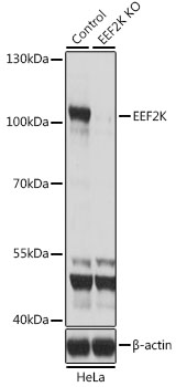 Western blot - EEF2K Polyclonal Antibody 