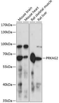 Western blot - PRKAG2 Polyclonal Antibody 