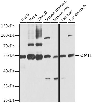Western blot - SOAT1 Polyclonal Antibody 