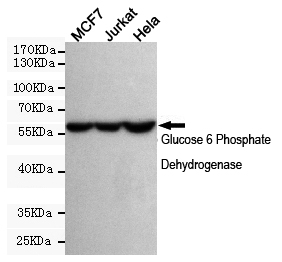 Western blot detection of Glucose 6 Phosphate Dehydrogenase in MCF7,Jurkat and Hela cell lysates using Glucose 6 Phosphate Dehydrogenase mouse mAb (dilution 1:500).Predicted band size:59 Kda.Observed band size:59KDa.