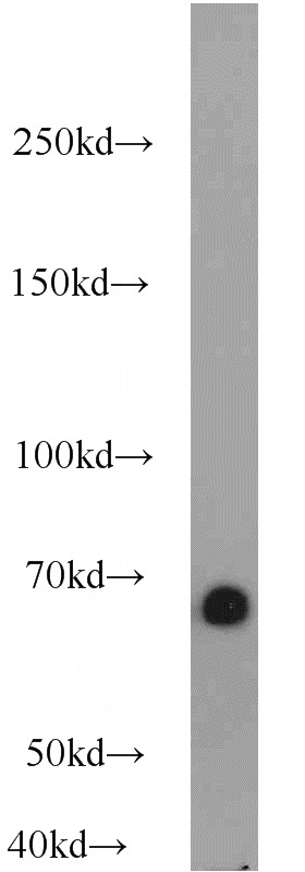 human blood tissue were subjected to SDS PAGE followed by western blot with Catalog No:107955(ALB antibody) at dilution of 1:10000