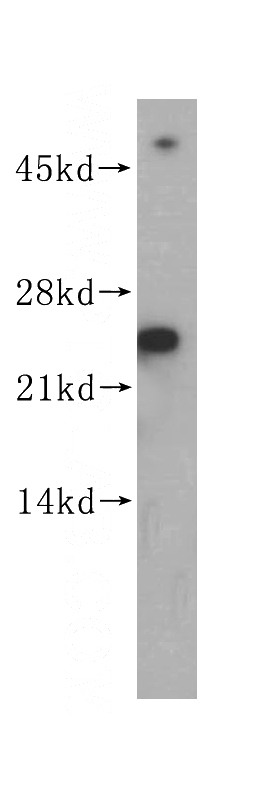 MCF7 cells were subjected to SDS PAGE followed by western blot with Catalog No:115077(SEC22B antibody) at dilution of 1:500