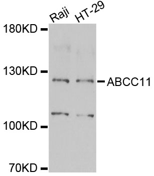 Western blot - ABCC11 Polyclonal Antibody 