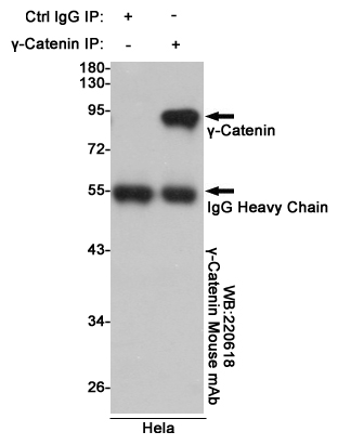 Immunoprecipitation analysis of Hela cell lysates using γ-Catenin mouse mAb.